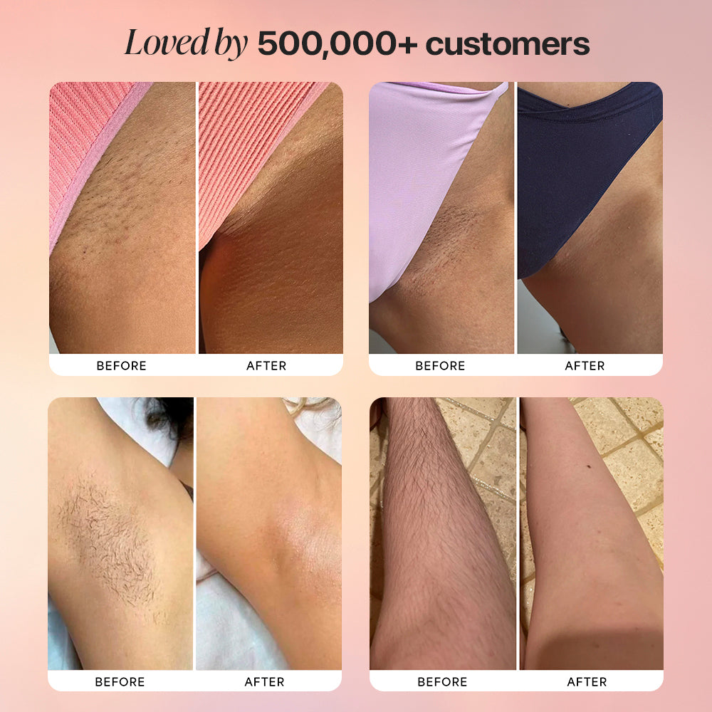 Dermave Trimmer customer results